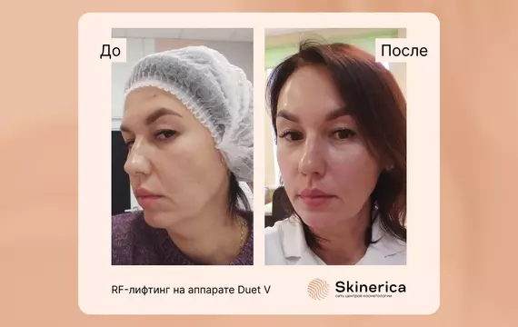 Результат 1