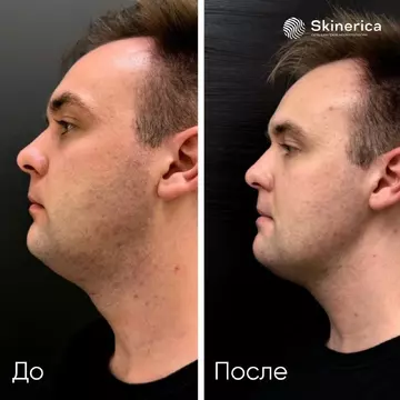 Результат 1