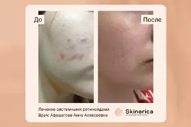 Анна Афашагова 1