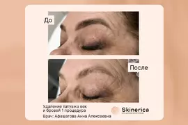 Анна Афашагова 2